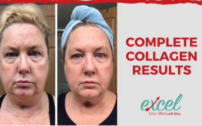 Check out these Complete Collagen results!