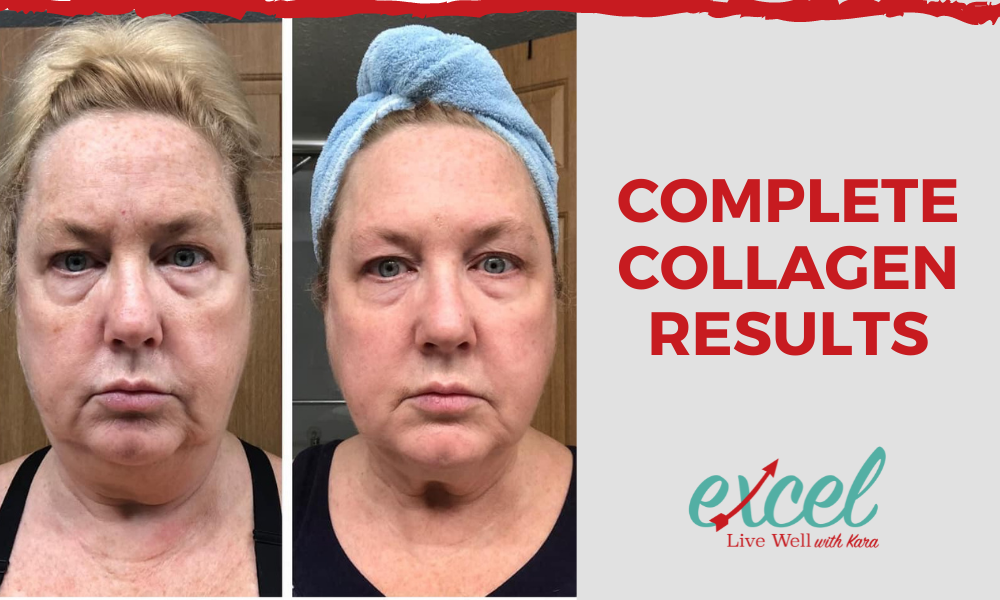 Check out these Complete Collagen results!